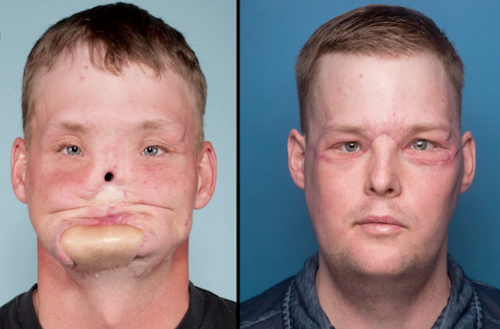 bizarre face transplant 