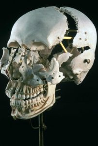 Beauchene Human Skull 