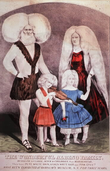 Albino Family