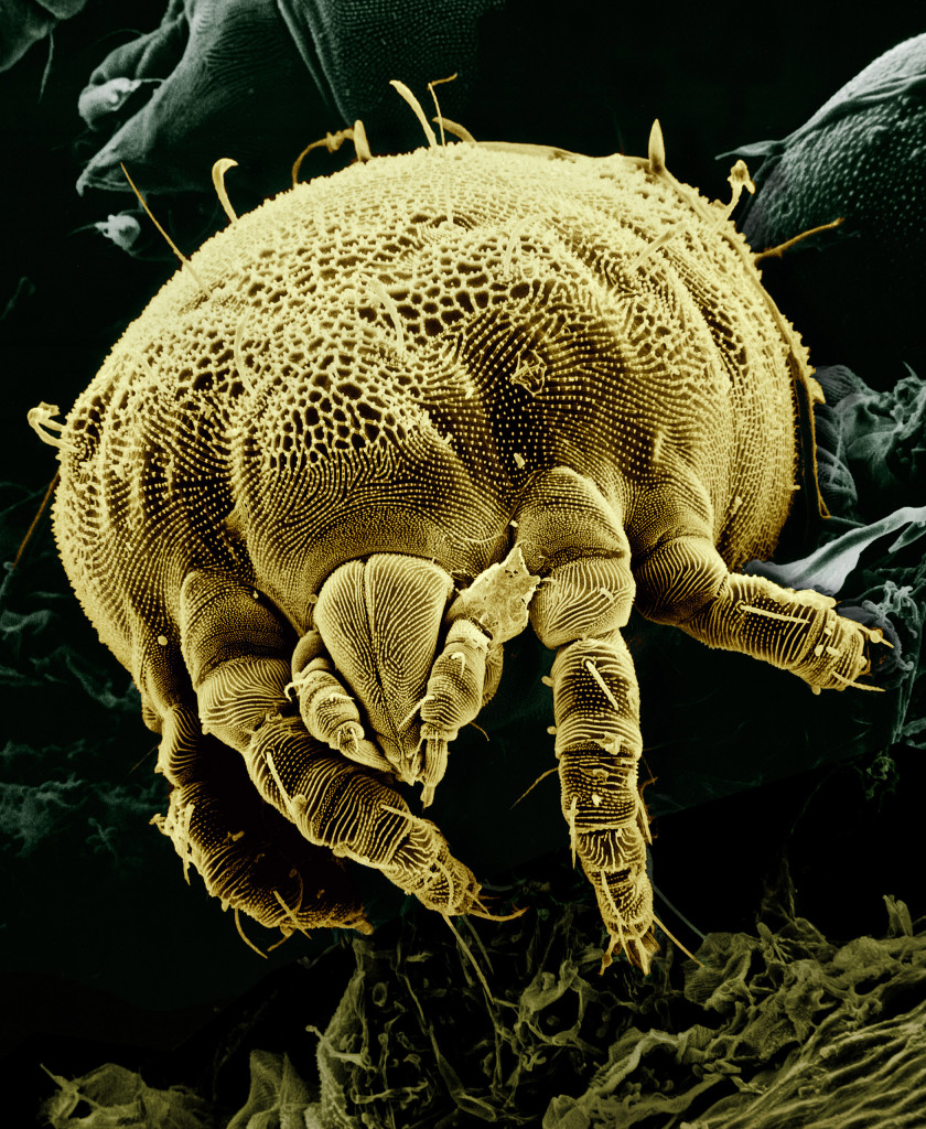 We All Have Tiny Mites That Live In Our Eyelashes
