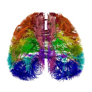 diagram of a mouse's brain