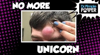 no more unicorn with Dr. Pimple Popper