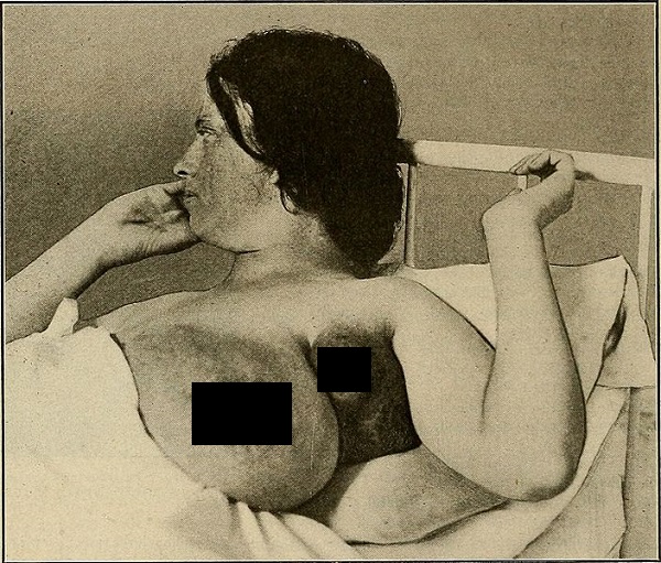 image of a three-breasted woman