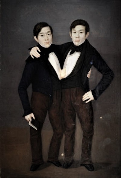 famous Siamese twins